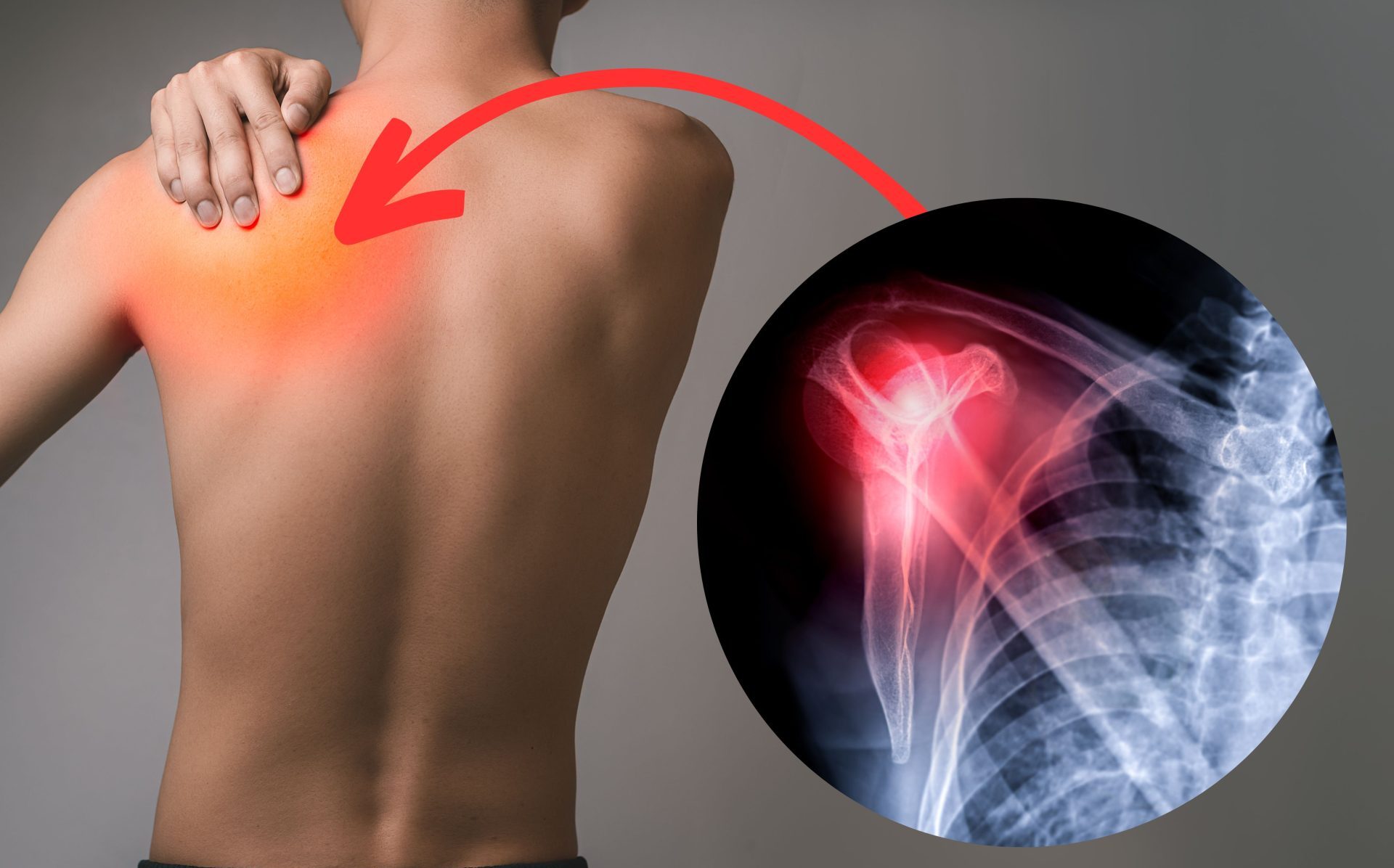 Can Weather Really Affect Joint Pain? The Truth About “Rain Pain”